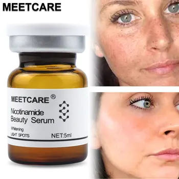 5ml Sarda Manchas Escuras Remoção Facial Essência Nicotinamida Extrato Natural de Soro para a Mesoterapia Microneedle Dermapen Clareamento